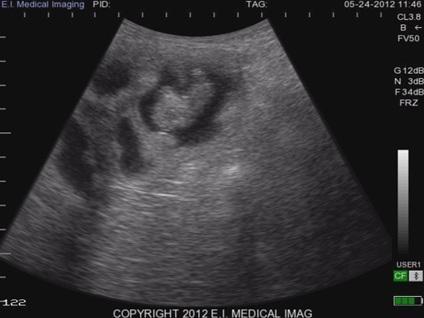 Koyunda ultrason