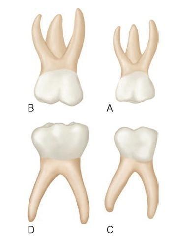 dişlerde 40-45 no'lu endodontik