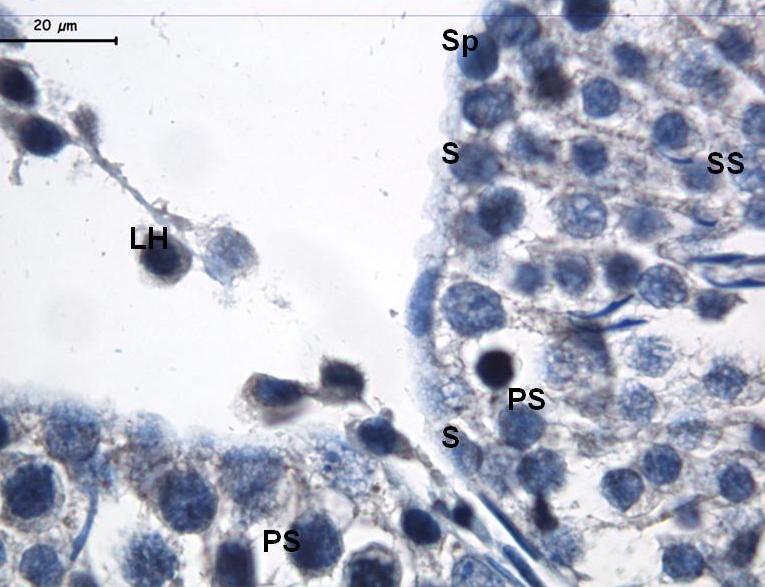 Resim 18: 500 mg/kg DBP uygulanan grupta AT1 boyamasında yapılan büyük büyültmeli incelemelerde; primer (PS) ve sekonder spermatositlerde (SS) belirgin çekirdek, zayıf
