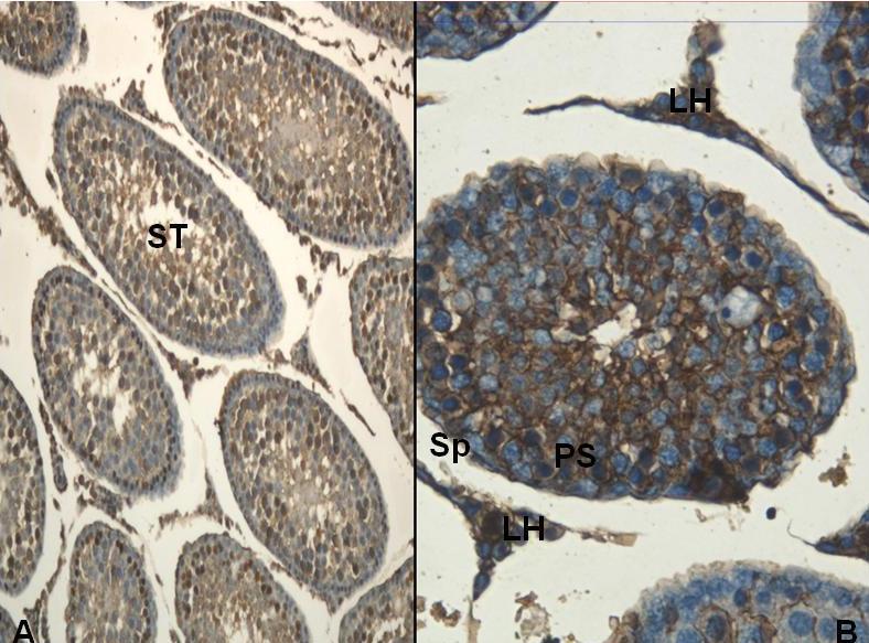 Resim 26: Kontrol grubuna ait ERα immün boyamasında; seminifer tübül (St) ve Leydig hücre (LH) çekirdeklerinde yoğun, sitoplazmada ise zayıf tutulum izleniyor.