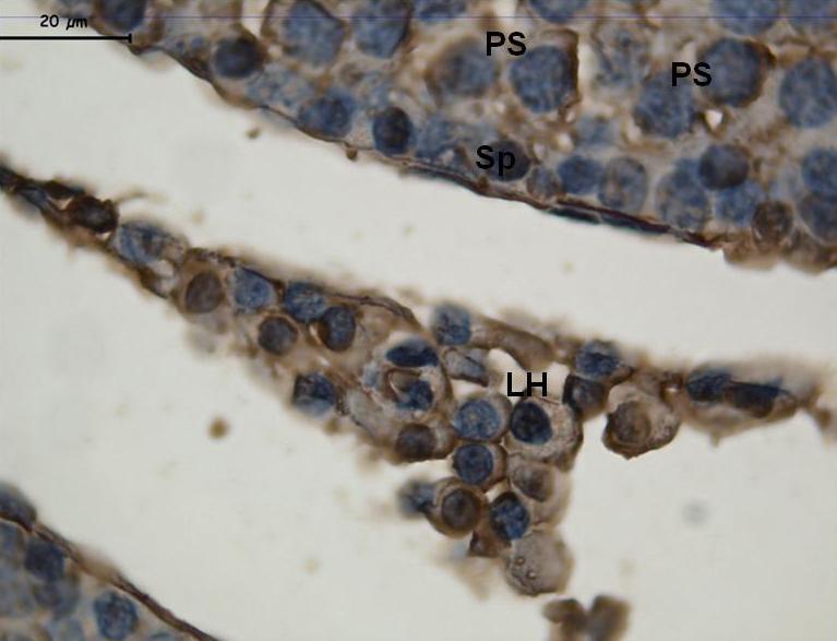 Resim 27: Kontrol grubuna ait daha büyük büyültmeli resimlerde, ERα tutulumunun, özellikle primer spermatosit (PS) ve Leydig