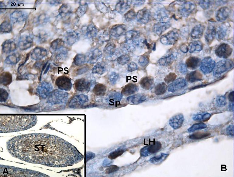Resim 28: CMC uygulanan grup ERα boyamasında; özellikle primer spermatosit (PS) ve Leydig hücrelerinde (LH)
