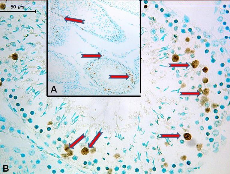 Resim 43: 1000 mg/kg DBP uygulanan grup testis dokusunun TUNEL yöntemi ile yapılan değerlendirmesinde; özellikle seminifer epitelde apoptotik hücrelerin ( )