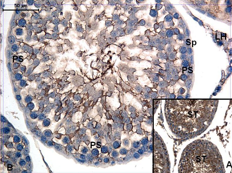 Resim 3: CMC uygulanan gruba ait c-kit boyamasında; seminifer tübül (ST) epitelinde zayıf tutulum gösteren spermatogonyumlar (Sp), zar ve sitoplazma tutulumu