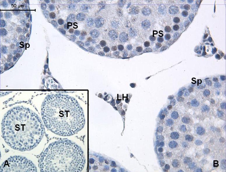 Resim 13: Kontrol grubuna ait AT1 boyamasında tutulumun, seminifer tübül (ST), primer spermatosit (PS) ve Leydig