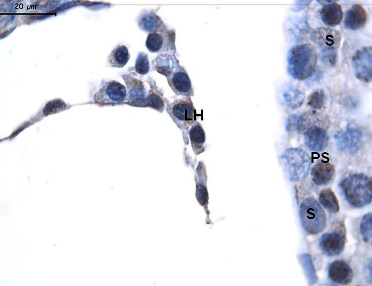Resim 14: Kontrol grubuna ait AT1 boyamasında yapılan büyük büyültmeli incelemelerde; primer spermatosit (PS), Sertoli