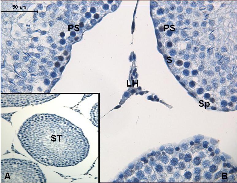 Resim 15: CMC uygulanan grupta doku genelinde AT1 immünreaktivitesi görülüyor.