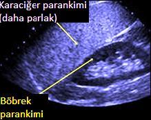 derecede yağlanma Karaciğer bakır