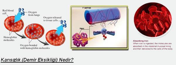 Ekonomik yönden yeterince gelişmemiş ülkelerdeki insanlarda, demir eksikliğinin daha yaygın ve ağır olacağı tartışılmaz bir gerçektir.