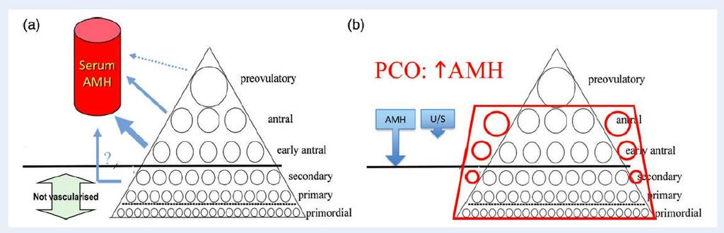 PCOS-AMH Dolaşımdaki AMH miktarı, normal gruba göre 2-4 kat daha FAZLADIR