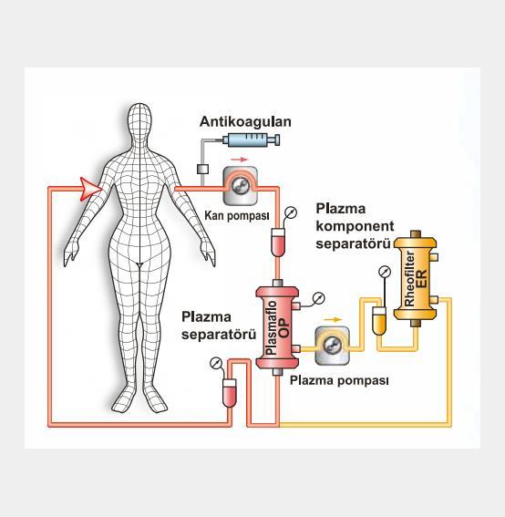 Seçici Plazmaferez Seçici plazmaferez hasta kanından filtre yardımı
