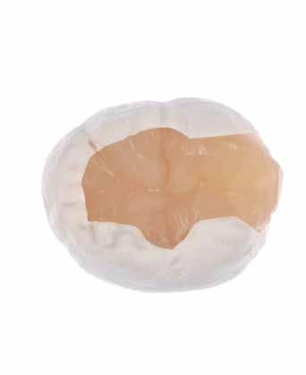 4.8 Bitirme 1 Dental porselenler için kullanılan konvansiyonel aşındırıcıların tamamı seramik