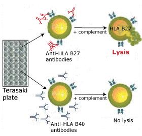 Serotiplendirme Lenfositler HLA spesifik alloab ile test edilir. Her serum mikroplak godesine eklenir.
