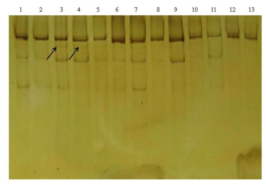 albicans suşları ve kontrol türlerine ait DNA örneklerinin %2 lik agaroz jeldeki PZR-RFLP görüntüleri. 1) 1 kb DNA ladder (marker), 2) C. albicans ATCC 90028 dan elde edilen DNA örneği, 3) C.
