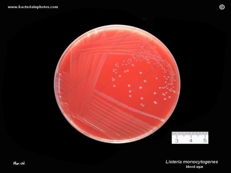 Listeria monocytogenes Işık mikroskopisi incelemesinde hareketli organizmalar (25- ⁰ C de takla at a şekli de karakteristik hareket, ⁰ C de hareketsiz)