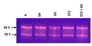 Saflaştırılan RNA larda 28S ve 18S ribozomal bantlarının varlığı ve herhangi bir yıkılım olmadığı görüldü (Şekil 3.9). Şekil 3.9. Araştırmada her bir gruba ait beyin doku örneklerinden saflaştırılan RNA lar.