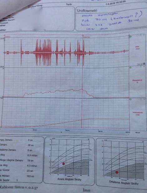 UROFLOW İşeme şekli: plato - staccato EMG: pelvik taban aktivitesi aktif Başlangıç zamanı: 0 sn Bitiş zamanı:38 sn İşemeye başlama zamanı: 5 sn Azami akış: 8.