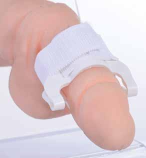 Klempin etrafını saran elastik bandaj radyal gücü çepere eşit dağıtır ve oluşan sıkma basıncını en aza indirir.