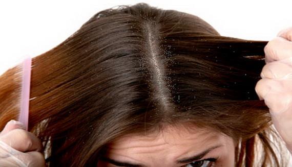 Dermis Kıllar Normal saçlı deride