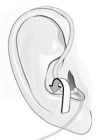 B C Ucunda kubbe takılı olmayan hoparlörü asla kulak kanalınıza sokmayın. Hoparlörü kulak kanalınızın çok derinine girmesi için zorlamayın.