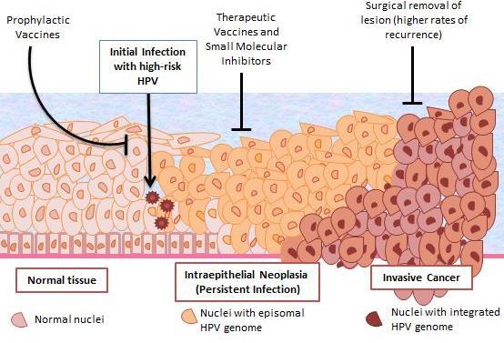 Gardasil : Tip 6-11-16-18 (Kız-erkek) 3.