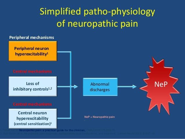 Nöropatik ağrıda Periferal sensitizasyon Fenotipik depişim Santral sensitizasyon