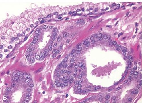 Robbins and Cotran Pathologic Basis of Disease, 9th ed.