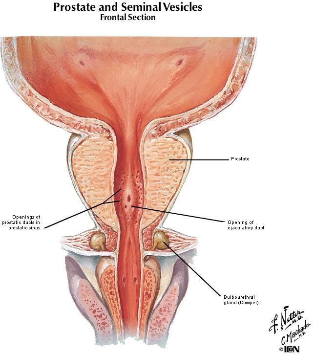 PROSTAT PATOLOJİSİ Normal erişkinde, 20gr Retroperitoneal