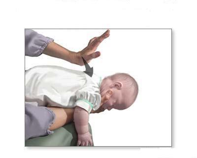 Bebeklerde Tam Tıkanıklık Olan Hava Bebek ilk yardımcının bir kolu üzerine ters olarak yatırılır,