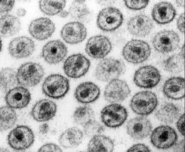 Viral Genom Yapı HIV, iki adet tek iplikli RNA içerir. Revers transkriptaz enzimi ile RNA dan çift iplikli DNA oluşur.