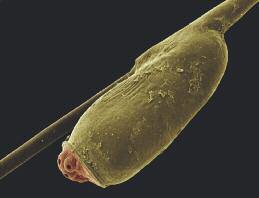 Saç biti nedir? Yumurta 1. 2. 3. Yetişkin bit Boş sirke Larva evresi 1 mm Saç bitleri kanatları olmayan, yaklaşık 1-4 milimetre uzunluğa sahip böceklerdir.