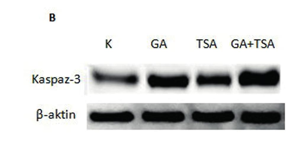 112 2B). Geldanamisin uygulaması sonrasında Bax/Bcl2 oranı Geldanamisinin apoptotik etkisini göstermek için ayrıca pro-apoptorik Bax ve anti-apoptotik Bcl2 protein ifade düzeylerini de incelendi.