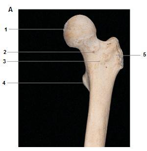 1) KALÇANIN KEMĠK YAPISI A) Femur proksimali kemik yapısı: Femur baģı, boynu ve küçük trokanterin 5 cm kadar distalini içine alan kemik yapıdır (ġekil 2).