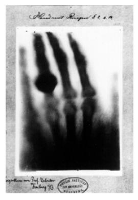 X-Işını Görüntüleme X-ışınları, vakum tüpleriyle deney yaparken şans eseri onu bulan Alman bilim adamı Vilhem Conrad Roentgen tarafından keşfedilmiştir.