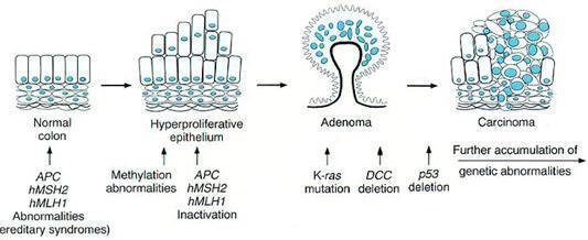 Gelişiminde Genetik Değişiklikler Normal Kolon APC hmsh2 hmlh1 Anormallikleri (Herediter sendromlar) Metilasyon anormallikleri Hiperproliferatif epitel APC hmsh2 hmlh1 İnaktivasyon Adenom Karsinom