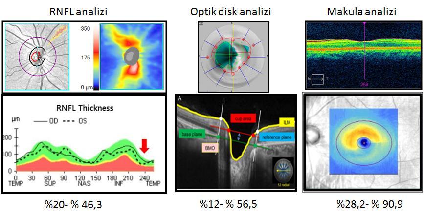 Tarama tipleri- Hata oranları 1. Asrani S, Essaid L, Adler B, Santiago-Turia C. JAMA Ophthalmol 2014;132:396-402 2. Hodzic-Hadzibegovic D, Sander BA, Luna Anderson H.