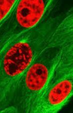 HÜCRE ORGANELLERİ VE GÖREVLERİ 2.Çekirdekçik: Bölünmeye hazırlanan hücrede kromatin yoğunlaşmaya başlar Hücrede bir veya daha fazla sayıda bulunabilir. Ribozom ve protein sentezinde aktif rol oynar.