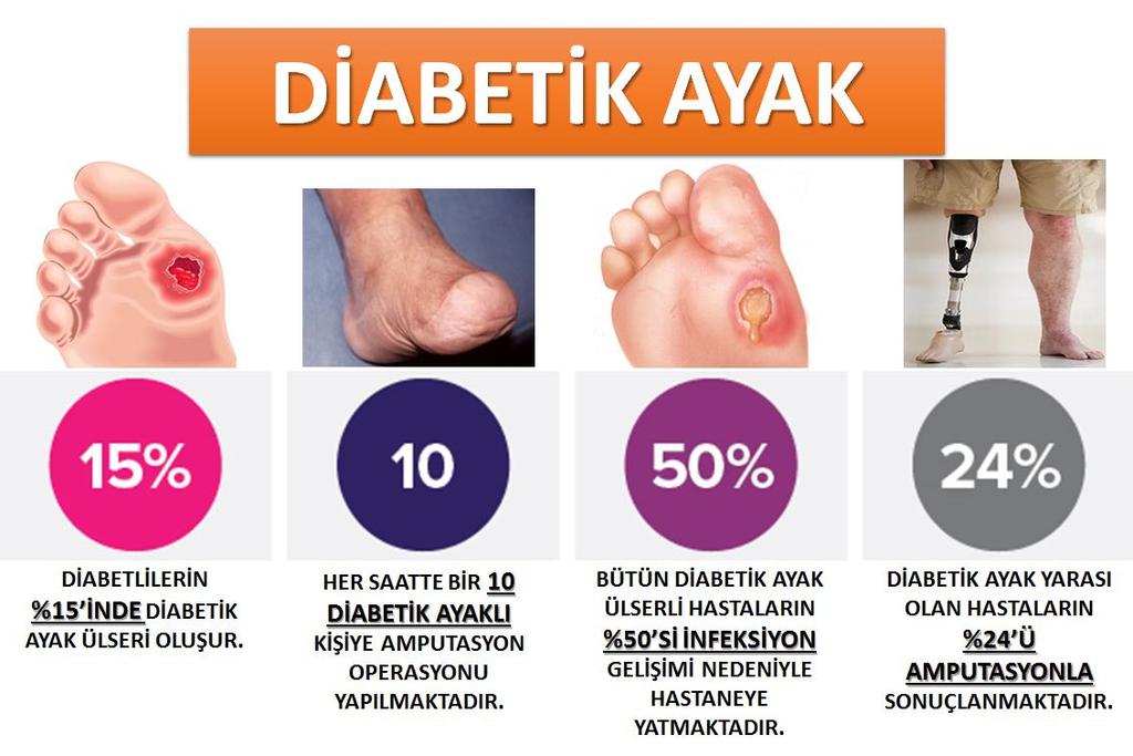 NE KADAR YAYGIN BİR PROBLEM? Diyabetik ayak yarası veya diyabetik ayak ülseri olarak adlandırılan bu sorun, diyabet hastalarının en önemli problemlerinden biridir.