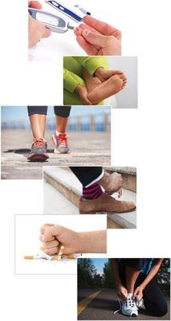 DİYABETİK AYAK YARASI TEDAVİSİ Diyabetik ayak yarası tedavisinde öncelikle diyabet kontrol altına alınır.