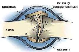Eklem kıkırdağından başlayıp, eklemlerde mekanik