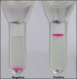 Selcuk Med J 2018;34(1): 1-5 Brucella Serolojik Testleri Tablo 1. Çalışılan testlerin pozitif ve negatif sonuçları (n) Çalışılan Testin Adı Pozitif Negatif Toplam Standart tüp ag.