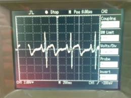 Labview kullanıcı ara yüzü ve alınan analog sinyal Şekil 19 da gerçekleştirilen uygulama için elde edilen EKG sinyali gözükmektedir.