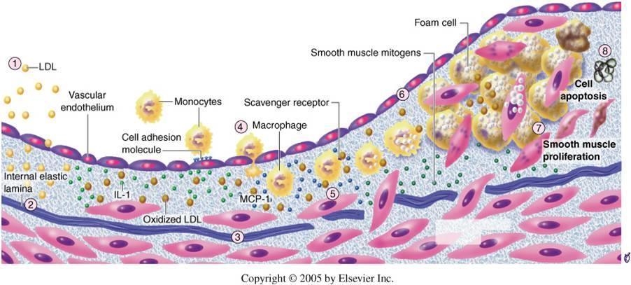 ATEROSKLEROZ Köpük Hücreler Düz Kas hücre Mitojenleri Vasküler Endotel Monosit