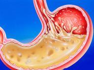 Bronkodilatör etkili ilaçlardır. Tükrük sekresyonlarında azalma sağlarlar. Antiemetik etkinlikleri mevcuttur. Antiaritmik etkileri mevcuttur. Üst solunum yolu enfeksiyonu bulgularını baskılarlar.