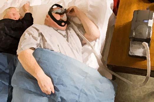 Apne Ciddi obez kişilerde uyku apne sendromu sıklıkla görülmektedir.