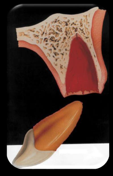 dentisyonda ortodontik tedavi Alveoler
