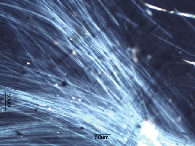 com) Şekil 3. a:krokidolit asbestin makro görünümü, b: Elektron mikroskopu altında iğne şekilli Krokidolit lifleri (http://www.periodic.table.