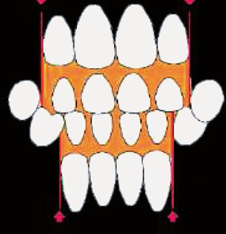 2,7,40 Karışık dişlenmenin bu ilk periyodunda alt ve üst birinci büyük azı dişlerinin kapanışa gelmesi 2.