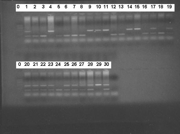 Cilt:33, Sayı: 4, (220-226) kanın alınmasından sonra, standart metodlarla lökositlerden DNA analizi Dicle Üniversitesi Tıp Fakültesi Tıbbi Biyoloji ve Genetik Anabilim Dalı nda yapıldı (10).