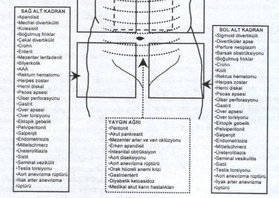 ..) Bir haftadan uzun süredir var olan ağrılar genellikle akut karın ile uyumlu değildir Akut ağrı ayrımına gitmek için ağrının devam ettiği süreden çok, şiddetlendiği an başlangıç noktası olarak